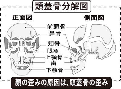 ほほ骨の出っ張りと頭蓋骨の分解図.png