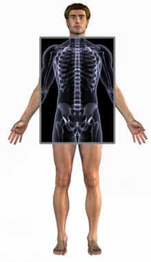 X線・人体透視図