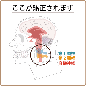 首の一点矯正と便秘