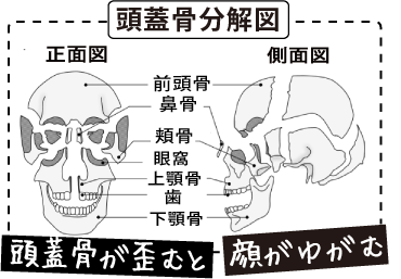 顔の歪みと頭蓋骨の分解図