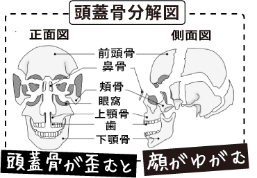 頭蓋骨 へこみ