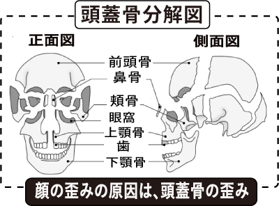 ほうれい線と顔のゆがみ