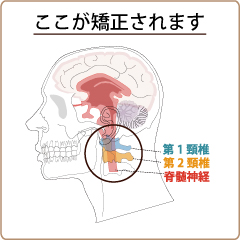 上部頚椎の矯正位置