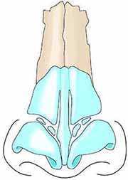 鼻の骨・鼻中隔湾曲症