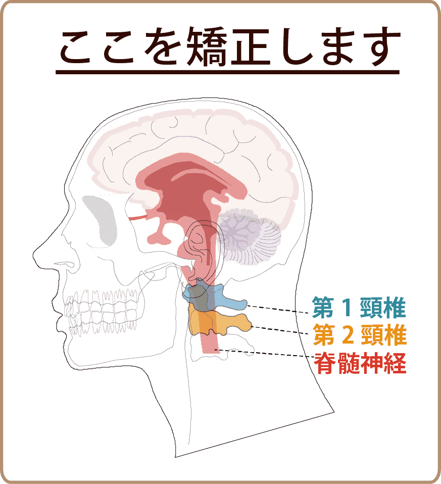 上部頚椎の矯正