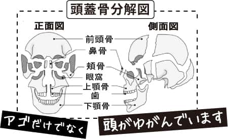 頭蓋骨の分解図