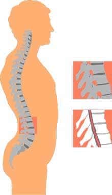 腰痛の部分図