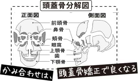 かみ合わせ矯正施術