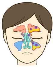 鼻炎と花粉症の原因