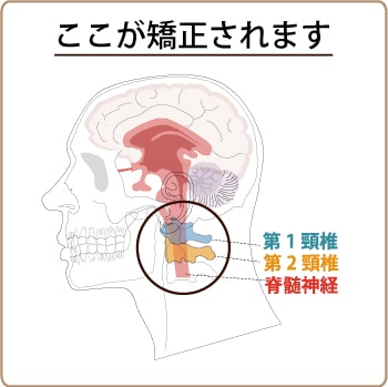 上部頚椎の矯正点