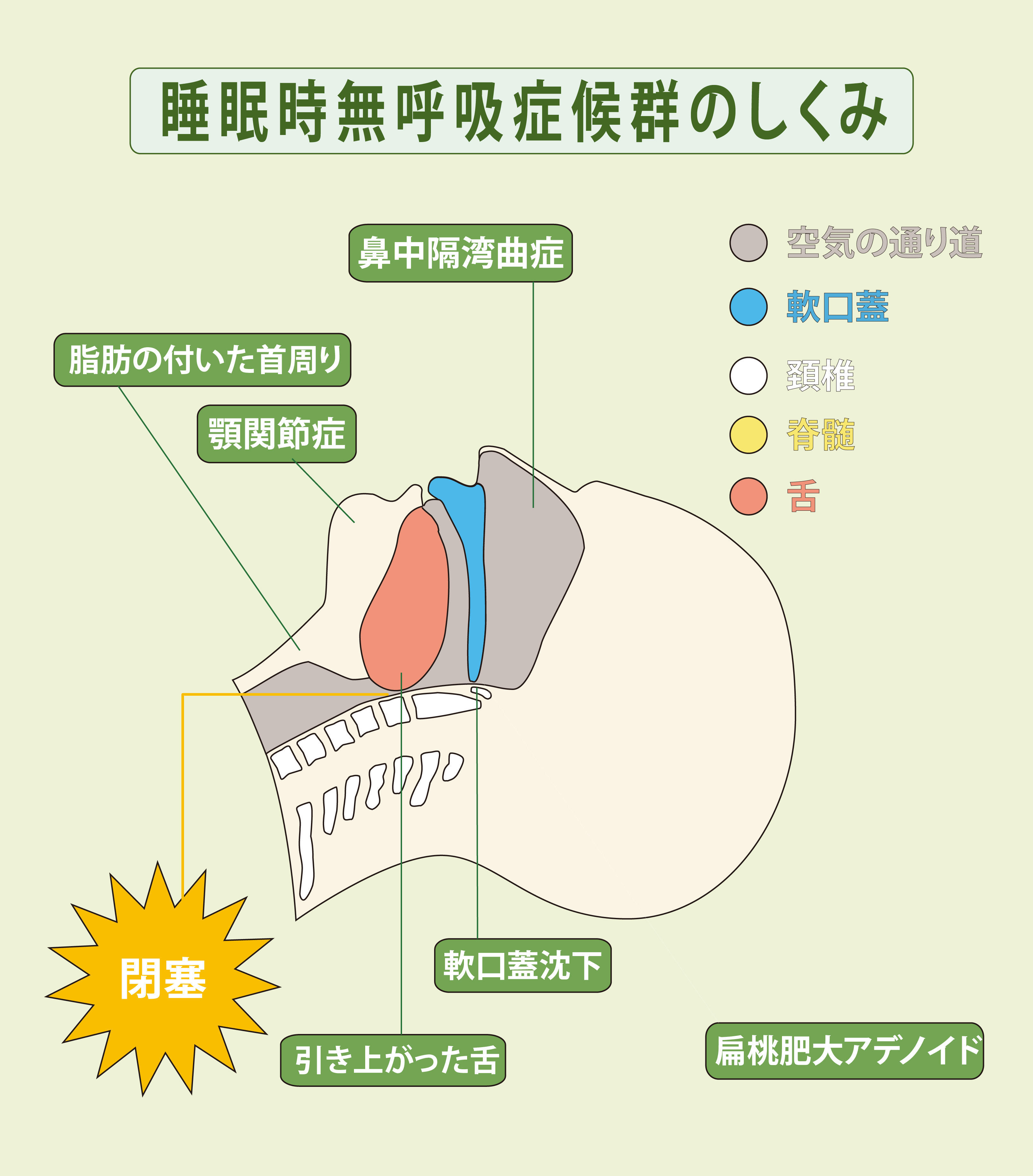 睡眠時無呼吸症候群(SAS)が起きるしくみ