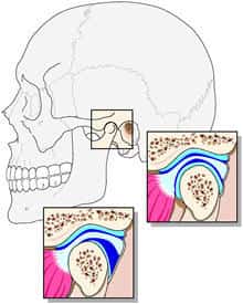 顎関節の関節円板