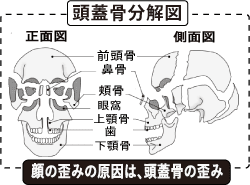 顔の歪みと頭蓋骨の分解図.png