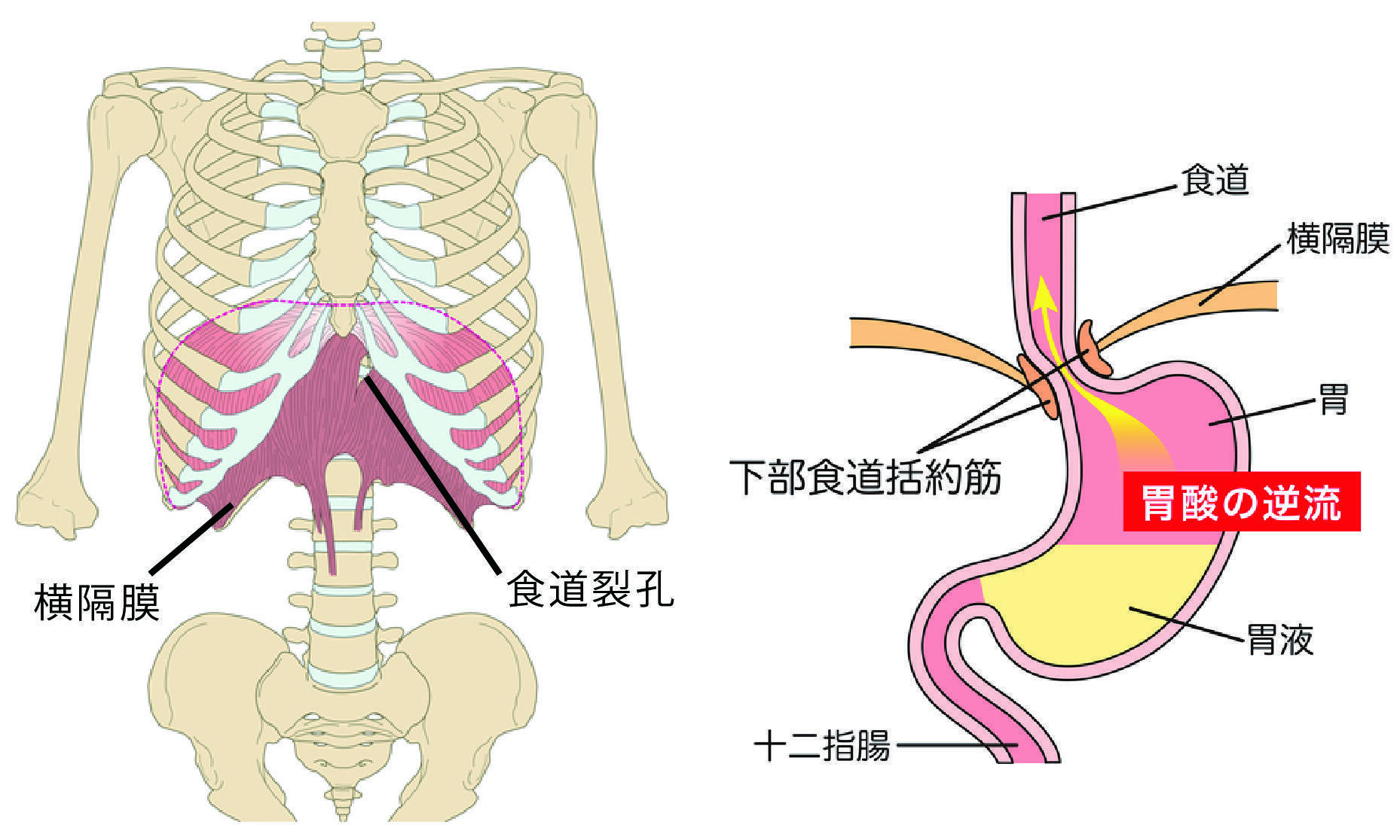 大 横隔膜と胃と内臓.jpg