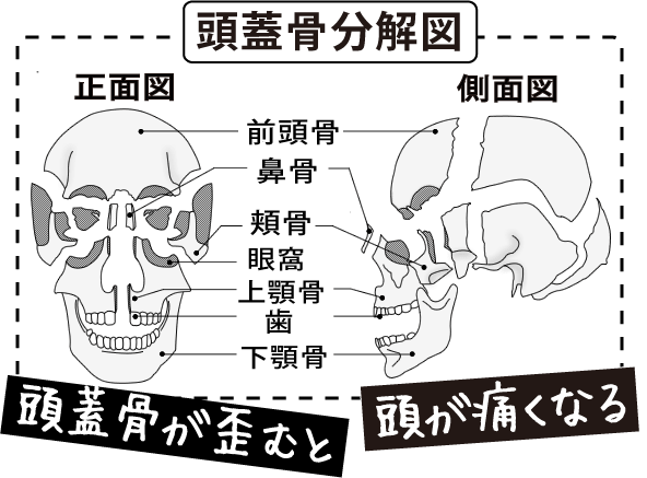 頭痛と頭蓋骨の分解図.png