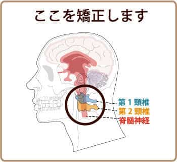 上部頚椎の矯正ポイント